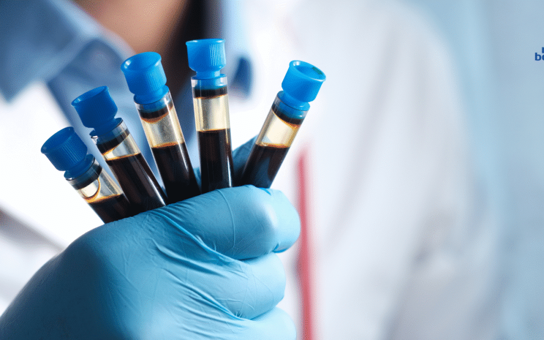 osocze bogatopłytkowe (prp)